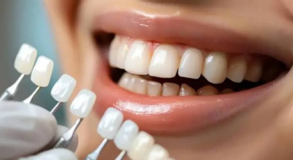Cosmetic Dentistry
